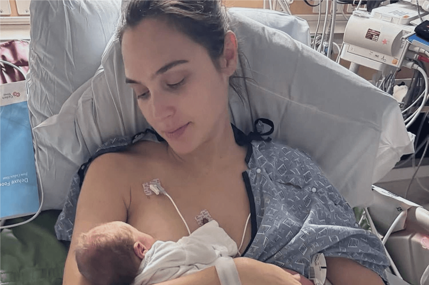 Gal Gadot’s Health Struggle: 5 Powerful Insights Into Her Blood Clot Diagnosis And What It Means For Her Future